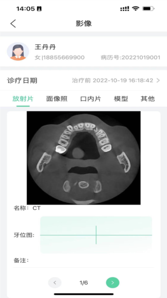 美亚美牙图片